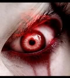 http://i171.photobucket.com/albums/u317/b_koppen/Bloody_Burning_Eye.jpg